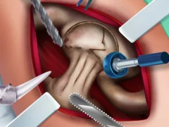 Mchezo Elsa Hips Surgery online