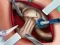 Igra Elsa Hips Surgery spletu