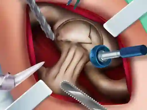Igra Elsa Hips Surgery spletu